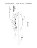 Sphincter treatment apparatus diagram and image