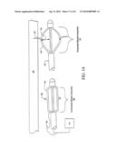 Sphincter treatment apparatus diagram and image