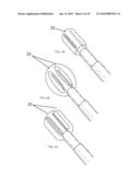 Electrosurgical Plenum diagram and image