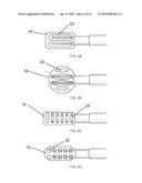 Electrosurgical Plenum diagram and image