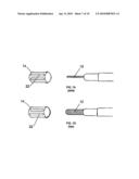 Electrosurgical Plenum diagram and image