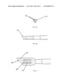 Electrosurgical Plenum diagram and image