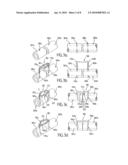 OSTEOSYNTHESIS CLIP AND INSERTION TOOL FOR USE WITH BONE TISSUE FRAGMENTS diagram and image