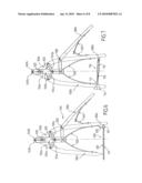 OSTEOSYNTHESIS CLIP AND INSERTION TOOL FOR USE WITH BONE TISSUE FRAGMENTS diagram and image