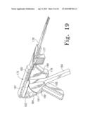 Tissue Distraction Device diagram and image