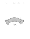 BIPOLAR INSTRUMENT AND METHOD FOR ENDOSCOPIC CONTROLLED SHORTENING AND/OR FRAGMENTATION OF STENTS ARRANGED IN GASTROINTESTINAL TRACT IN THE TRACHEOBRONCHIAL SYSTEM OR IN OTHER HOLLOW ORGANS diagram and image