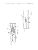 Mechanical Embolectomy Device and Method diagram and image