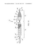 Mechanical Embolectomy Device and Method diagram and image