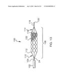 Mechanical Embolectomy Device and Method diagram and image