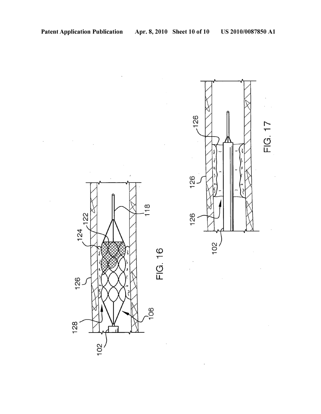 Mechanical Embolectomy Device and Method - diagram, schematic, and image 11