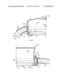 TEMPORARY SURGICAL CLOSURE FOR A BODY CAVITY diagram and image