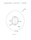 TEMPORARY SURGICAL CLOSURE FOR A BODY CAVITY diagram and image