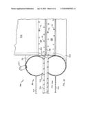 TEMPORARY SURGICAL CLOSURE FOR A BODY CAVITY diagram and image