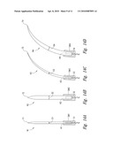 BARBED SUTURE IN COMBINATION WITH SURGICAL NEEDLE diagram and image