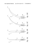 BARBED SUTURE IN COMBINATION WITH SURGICAL NEEDLE diagram and image