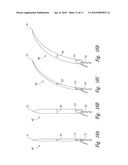 BARBED SUTURE IN COMBINATION WITH SURGICAL NEEDLE diagram and image