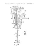 Soft Tissue Repair Device and Method diagram and image