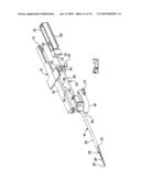 Soft Tissue Repair Device and Method diagram and image