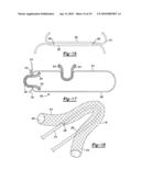 Soft Tissue Repair Device and Method diagram and image