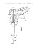 Soft Tissue Repair Device and Method diagram and image