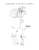 Soft Tissue Repair Device and Method diagram and image