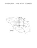 Soft Tissue Repair Device and Method diagram and image