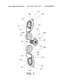 SPINOUS PROCESS FIXATION IMPLANT diagram and image