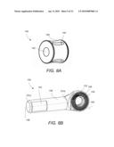 SPINOUS PROCESS FIXATION IMPLANT diagram and image