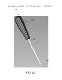 SPINOUS PROCESS FIXATION IMPLANT diagram and image