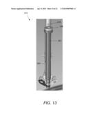 SPINOUS PROCESS FIXATION IMPLANT diagram and image