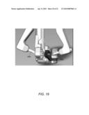 SPINOUS PROCESS FIXATION IMPLANT diagram and image