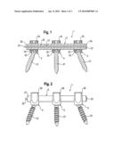 ROD-SHAPED IMPLANT IN PARTICULAR FOR STABILIZING THE SPINAL COLUMN AND STABILIZATION DEVICE INCLUDING SUCH A ROD-SHAPED IMPLANT diagram and image