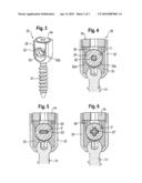 ROD-SHAPED IMPLANT IN PARTICULAR FOR STABILIZING THE SPINAL COLUMN AND STABILIZATION DEVICE INCLUDING SUCH A ROD-SHAPED IMPLANT diagram and image