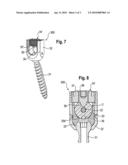 ROD-SHAPED IMPLANT IN PARTICULAR FOR STABILIZING THE SPINAL COLUMN AND STABILIZATION DEVICE INCLUDING SUCH A ROD-SHAPED IMPLANT diagram and image