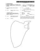 METHODS OF IMPLANTING GLENOID INLAY diagram and image