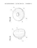 METHODS OF IMPLANTING GLENOID INLAY diagram and image