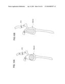 METHODS OF IMPLANTING GLENOID INLAY diagram and image