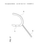 METHODS OF IMPLANTING GLENOID INLAY diagram and image