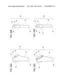 METHODS OF IMPLANTING GLENOID INLAY diagram and image