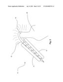 SYSTEMS AND METHODS FOR VALVE ANNULUS REMODELING diagram and image