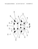 SYSTEMS AND METHODS FOR VALVE ANNULUS REMODELING diagram and image