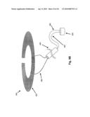 SYSTEMS AND METHODS FOR VALVE ANNULUS REMODELING diagram and image