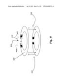 SYSTEMS AND METHODS FOR VALVE ANNULUS REMODELING diagram and image