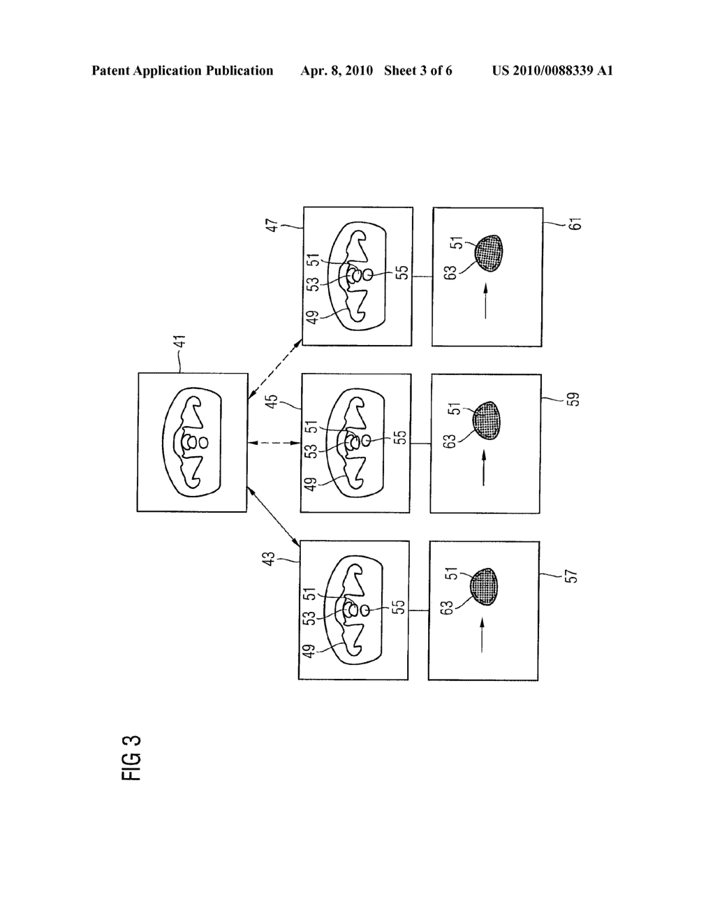 METHOD AND DEVICE FOR SELECTING AN IRRADIATION PLAN AND IRRADIATION FACILITY - diagram, schematic, and image 04