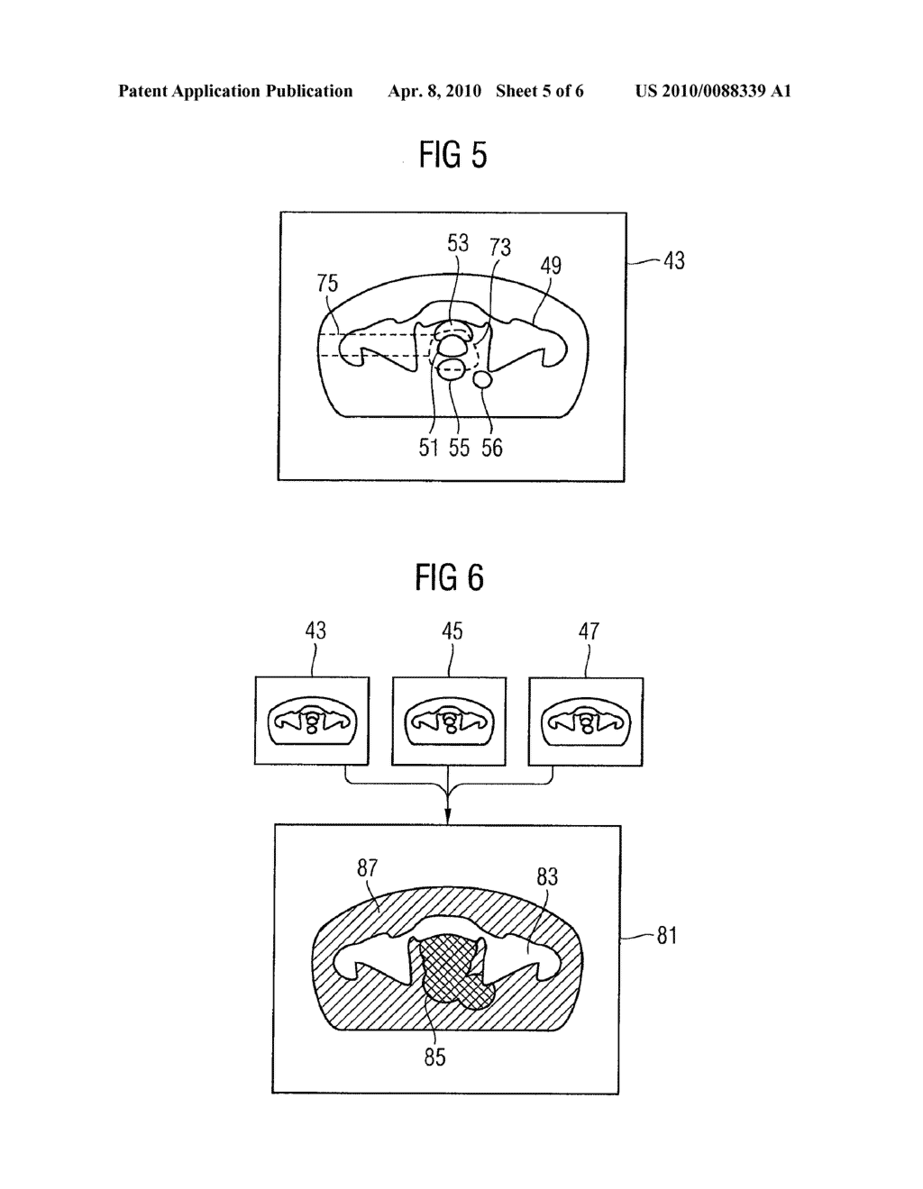 METHOD AND DEVICE FOR SELECTING AN IRRADIATION PLAN AND IRRADIATION FACILITY - diagram, schematic, and image 06