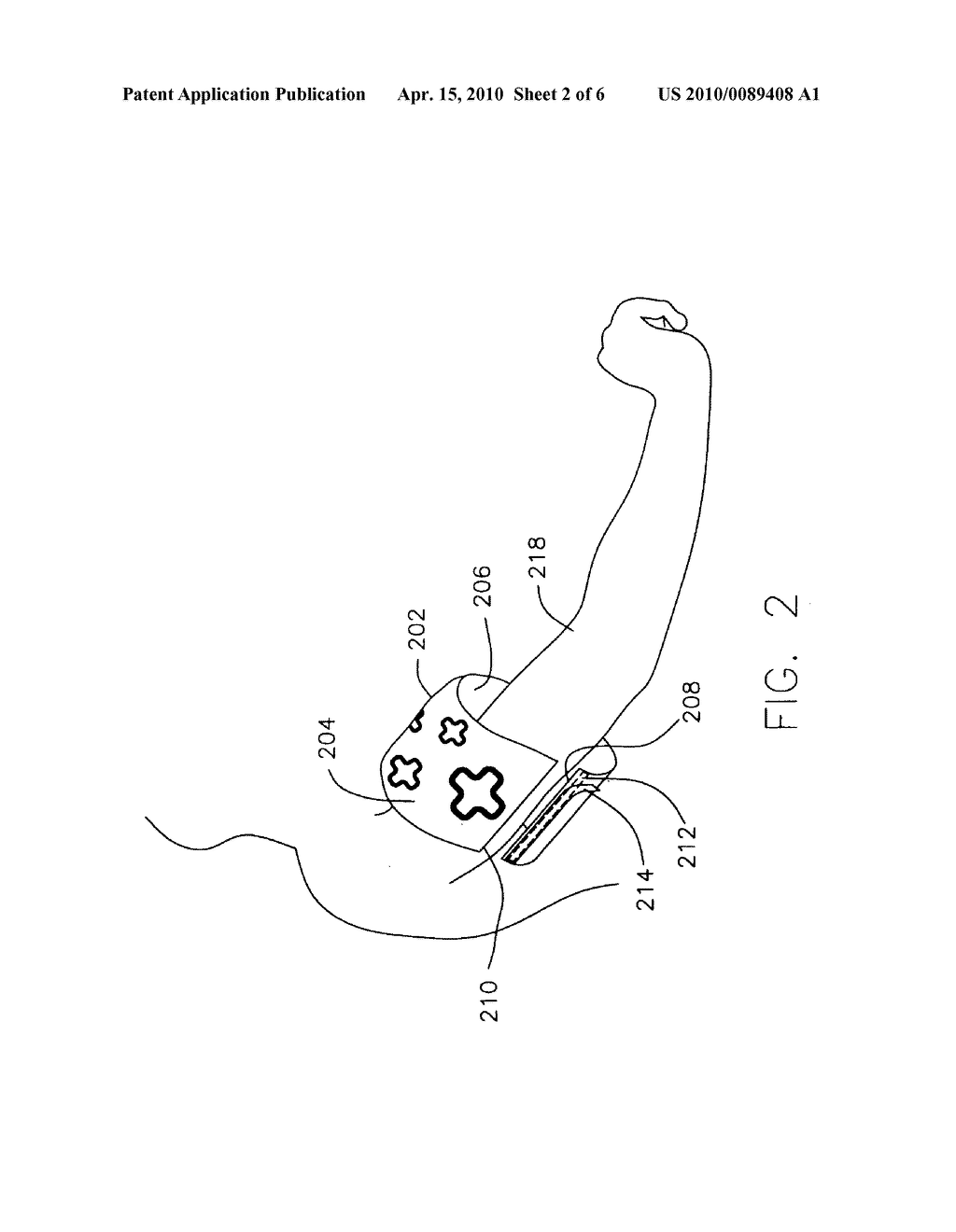 ANTIMICROBIAL BLOOD PRESSURE CUFF - diagram, schematic, and image 03