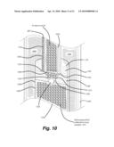 DEWATERING APPARATUS diagram and image