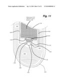 DEWATERING APPARATUS diagram and image