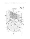 DEWATERING APPARATUS diagram and image