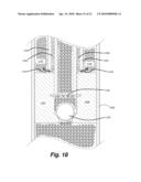 DEWATERING APPARATUS diagram and image